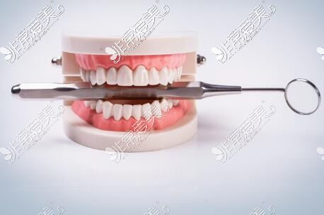 牙齿综合治疗改善