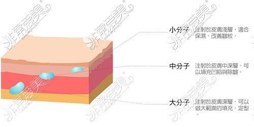 玻尿酸详解示例