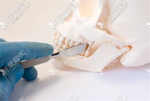 人体头骨模型