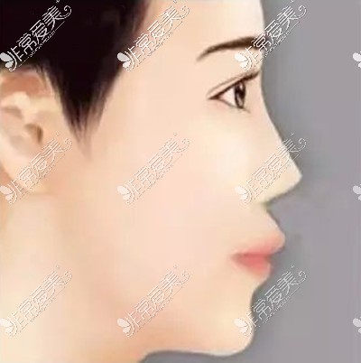 突嘴的人大多看起来鼻基底凹陷