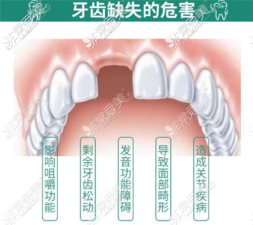 2022年牙科收费价目表更新,口腔科收费价目表含种牙矫正费用