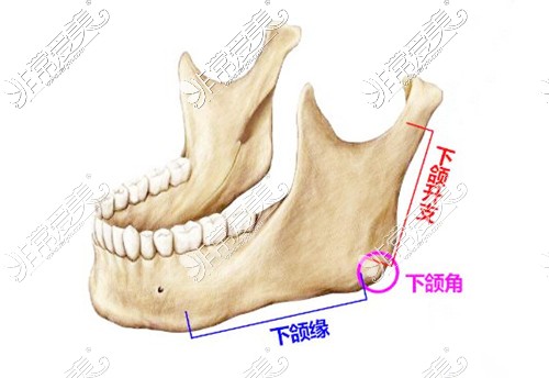 武汉吴中兴截骨怎么样?武汉中翰吴中兴下颌角手术日记展示