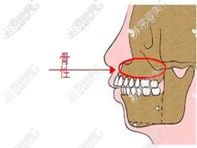 正常牙骨侧面图片图片