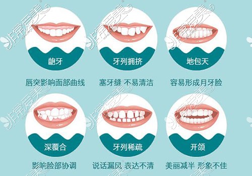 各种牙齿不齐情况