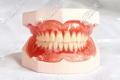 BPS吸附性义齿