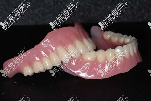 BPS生物功能性吸附性义齿