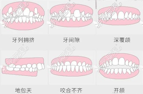 长春二道区牙齿矫正哪家好？这些牙科牙齿矫正技术受认可