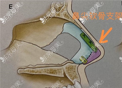 汪发生医生擅长鼻整形吗