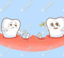 牙齿缺牙漫画图