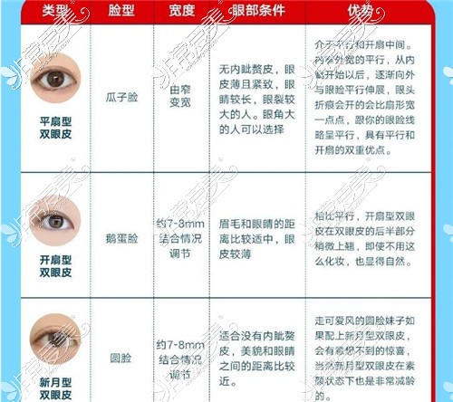不同类型双眼皮的优势及适合人群图示