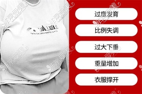 巨乳癥副作用圖