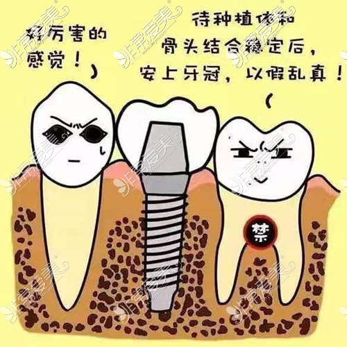 种植牙是牙齿修复较佳选择