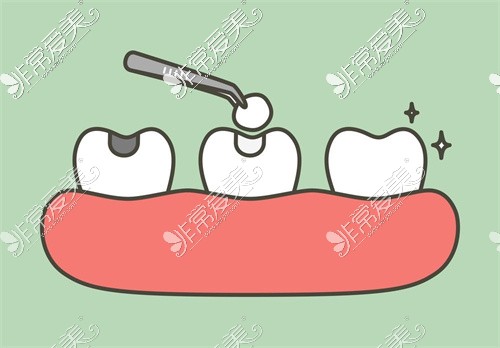 泸州口腔医院补牙卡通图