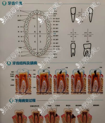 牙齿疾病发展情况