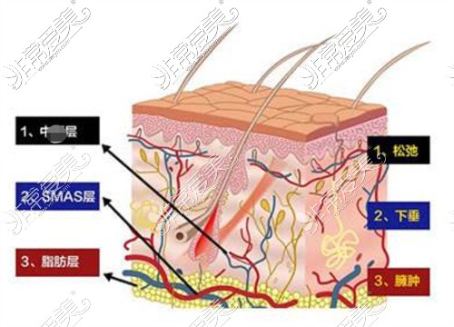 瀘州市醫(yī)美花都整形皮膚分層細節(jié)圖