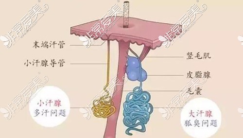 汗腺卡通图展示照片