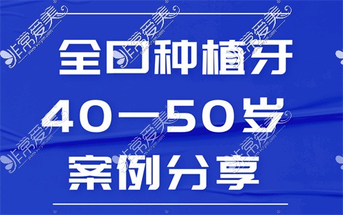 全口種植牙40一50歲病歷