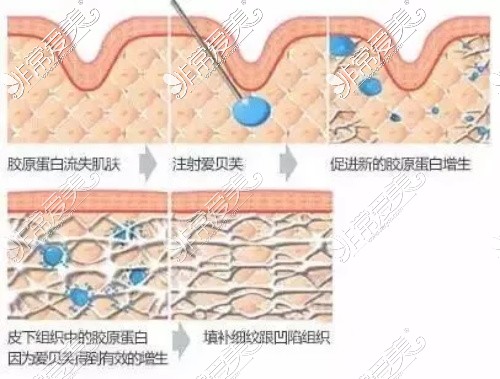 爱贝芙变化过程示意图