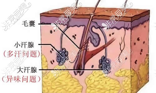 小切口腋臭手术图解图片