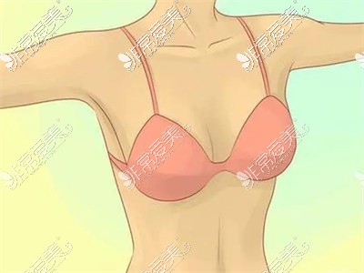 假体隆胸后胸部形态