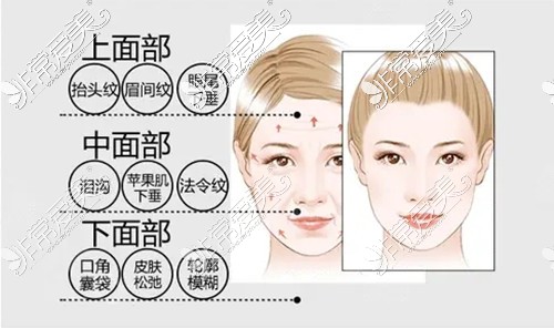 pst面部提升适应症是什么