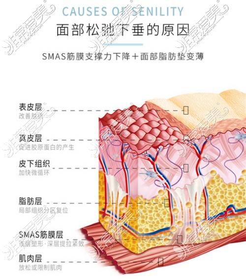 皮肤层次示意图