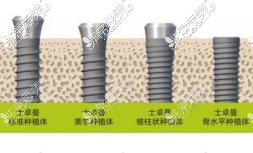 瑞士ITI種植體三種檔次價(jià)格