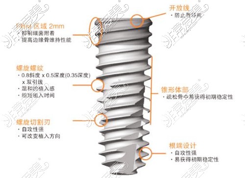 为什么奥齿泰比登腾贵?3点对比清楚同是韩国种植牙该选谁