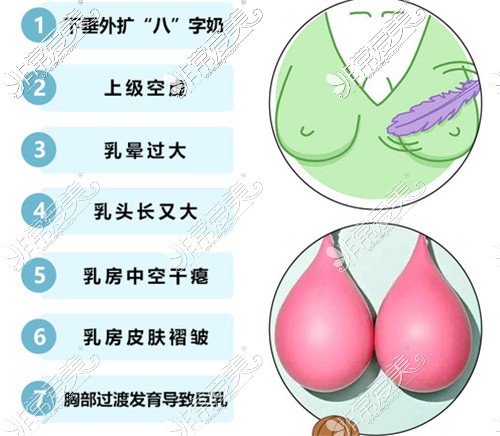 不同的乳房问题展示