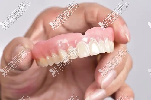 上牙全部掉了怎么固定假牙？
