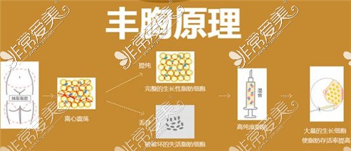 棉花糖丰胸和假体丰胸哪个好?韩啸棉花糖丰胸骗局是真是假?