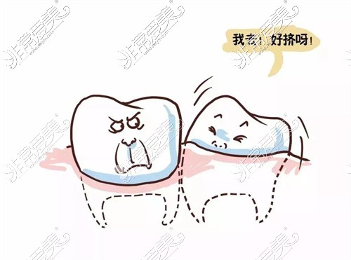 雅安牙体牙髓治疗图