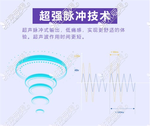 超脉冲技术介绍