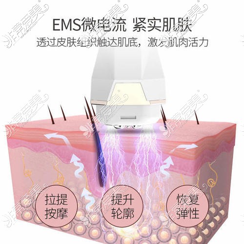 热玛吉示意图