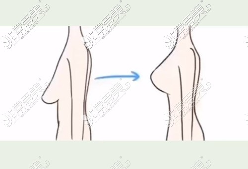 胸下夹笔下垂图片