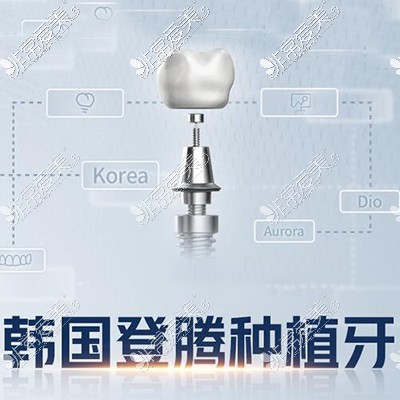 韩国登腾种植牙材料