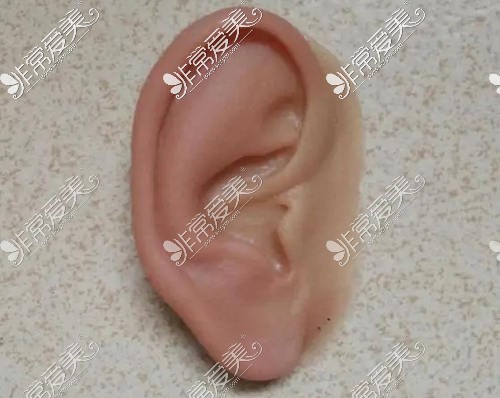 耳朵整形多少钱