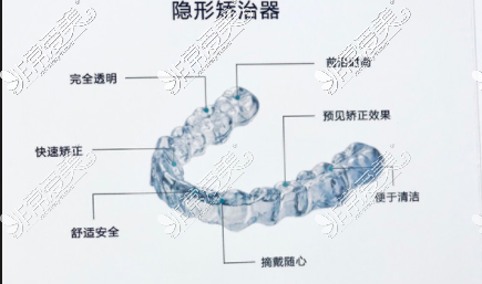 隱形矯正器照片