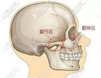 颧弓颧骨部门解析图