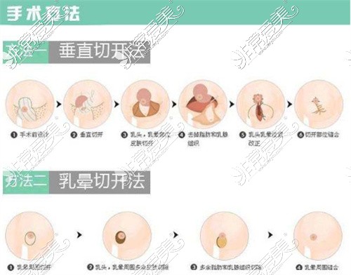 四川成都画美医疗美容赵敬国缩小示意图