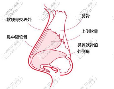 隆鼻改善卡通图展示