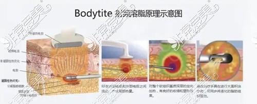 长沙美研整形黄金微雕