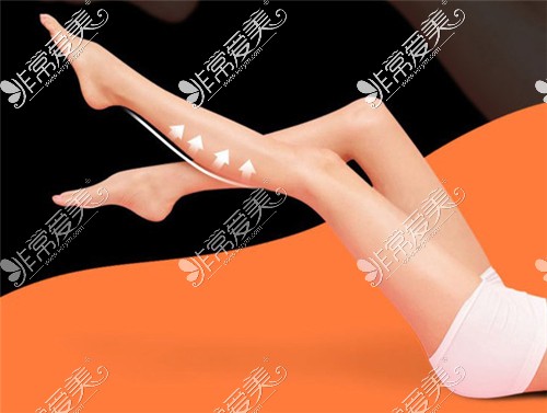 上海丽质整形直腿术宣传图