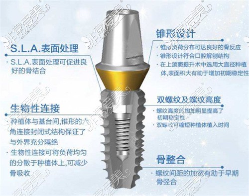 韩国登特种植牙介绍