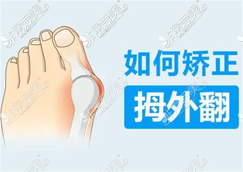 拇外翻大腳骨示意圖