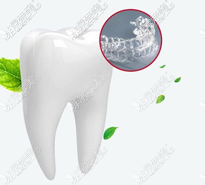 隐形正畸改善牙齿展示图