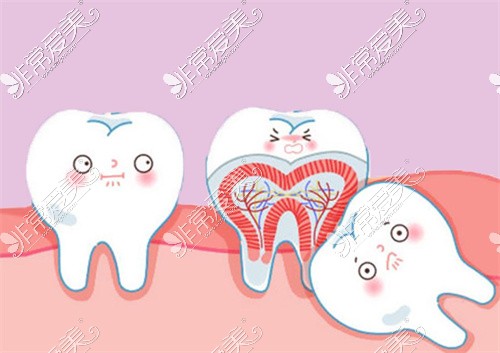 广安牙科拔牙卡通图