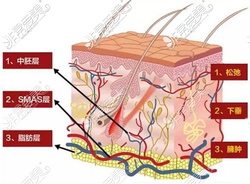 皮肤组织示意图