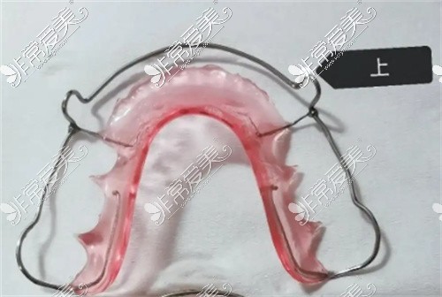 广元牙齿矫正保持器