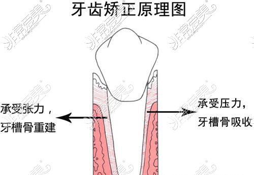 看重庆舌侧牙套矫正价格,了解舌侧牙套大概多少费用好多钱!